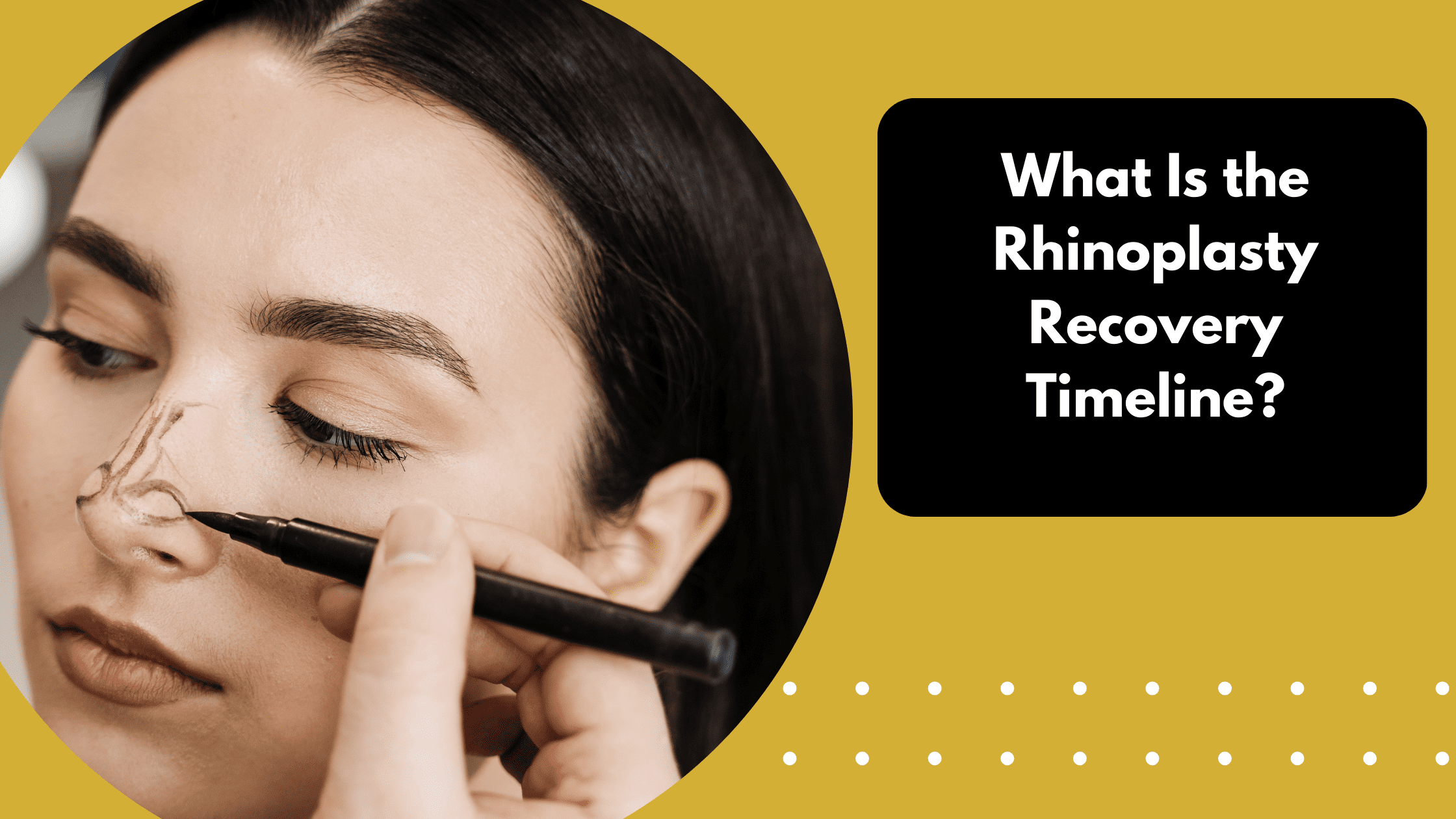 What Is the Rhinoplasty Recovery Timeline?